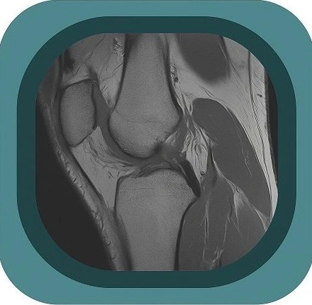 MRI knee anatomy icon